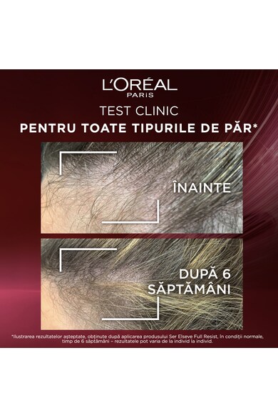 L'Oreal Paris Комплект  Elseve Full Resist за усъвършенствана грижа за крехка коса със склонност към окапване Жени