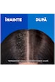 Head&Shoulders Sampon anti-matreata  Men Ultra Total Care, 625 ml Barbati